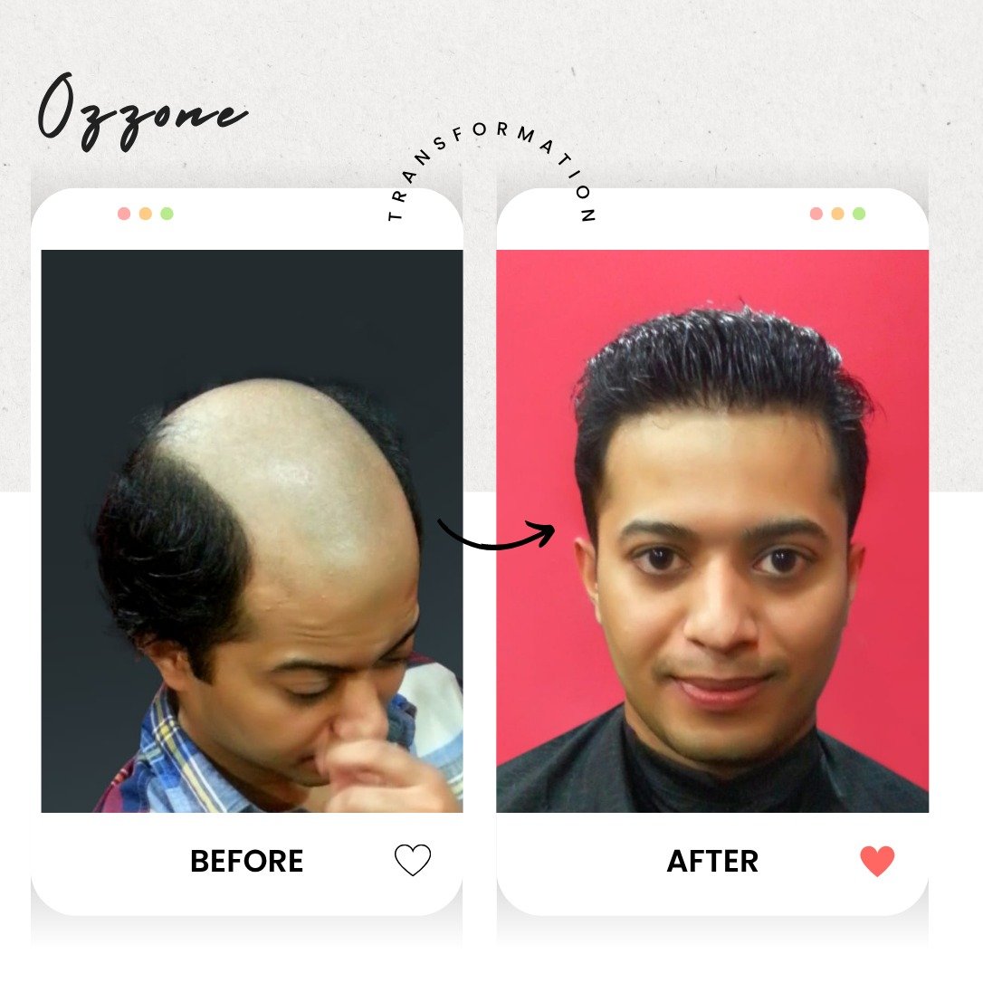 Before and after hair fixing result at Ozzone Trivandrum